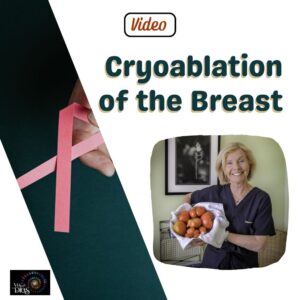 Cryoablation of the Breast - Store Video Product Pic